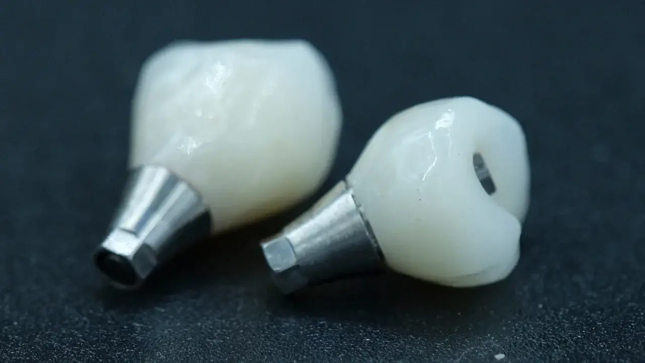 how-does-custom-made-abutment-differ-from-abutment