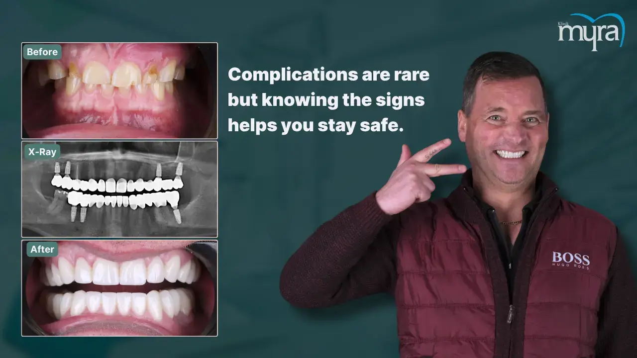 6-complications-can-include-infection-or-nerve-damage