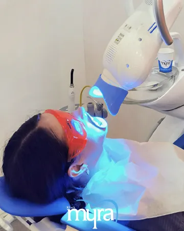 teeth-whitening-definition-types-cost-and-recovery-duration,
