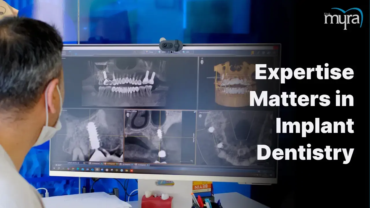 2-choose-an-experienced-and-certified-dental-implant-specialist