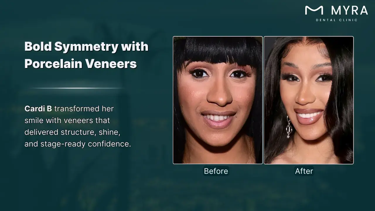 21-cardi-b