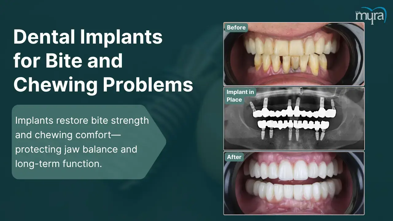 5-bite-and-chewing-issues