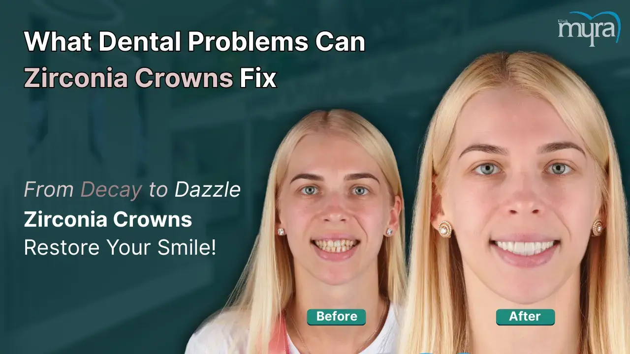 what-common-dental-problems-can-be-fixed-by-zirconia-crowns