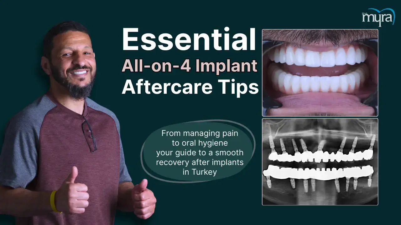 what-are-the-aftercare-requirements-after-getting-an-all-on-4-implant-in-turkey