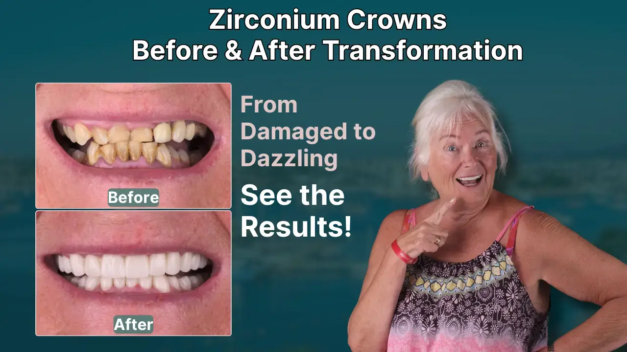 zirconium-crowns-before-and-after