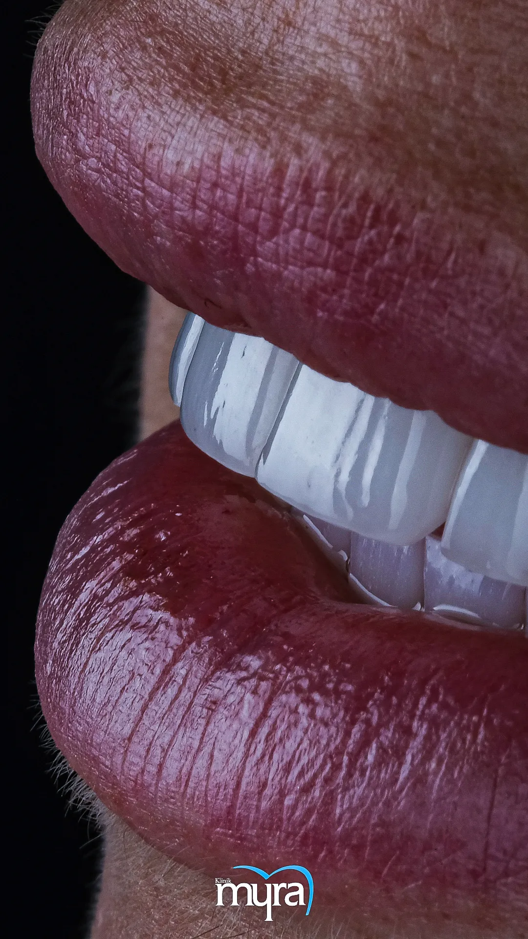 principles-of-smile-design,