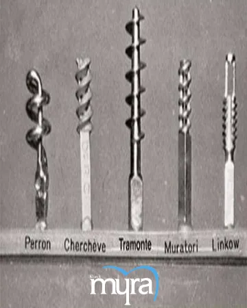 history-of-dental-implant,
