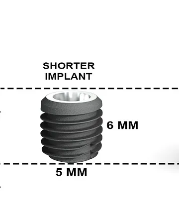 mini-dental-implant-definition-advantages-disadvantages-and-average-cost