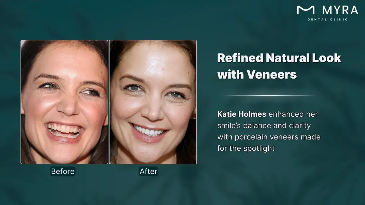10-katie-holmes
