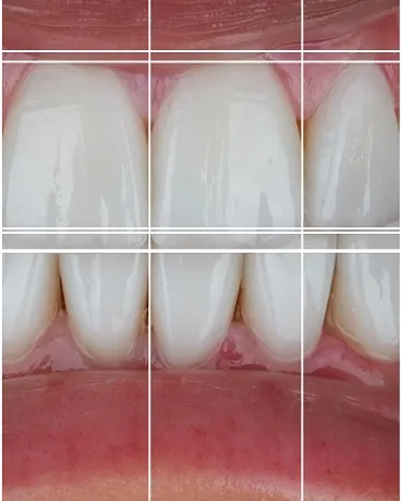 facial-esthetics-in-dentistry-definition-and-different-procedures,