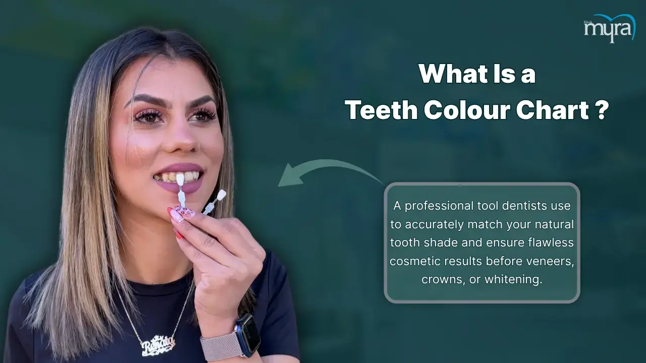 what-is-a-teeth-colour-chart