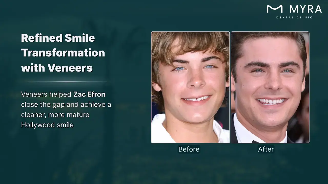 4-zac-efron