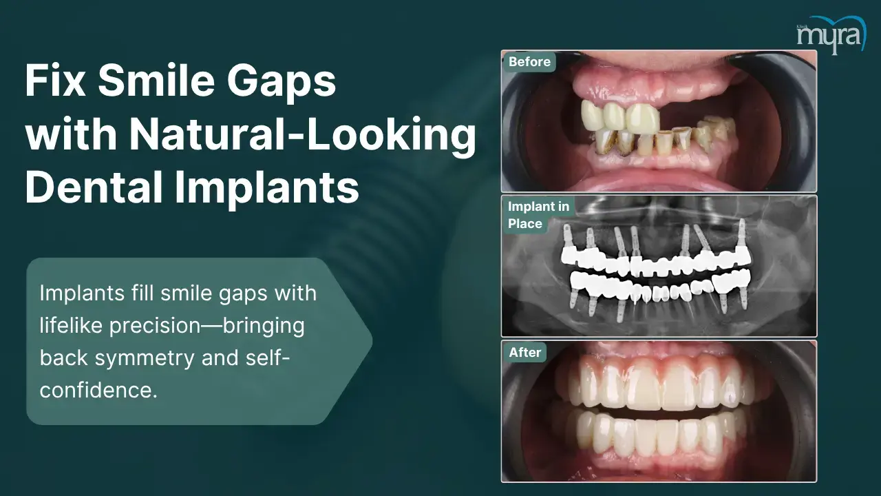 7-smile-gaps-and-aesthetic-concerns