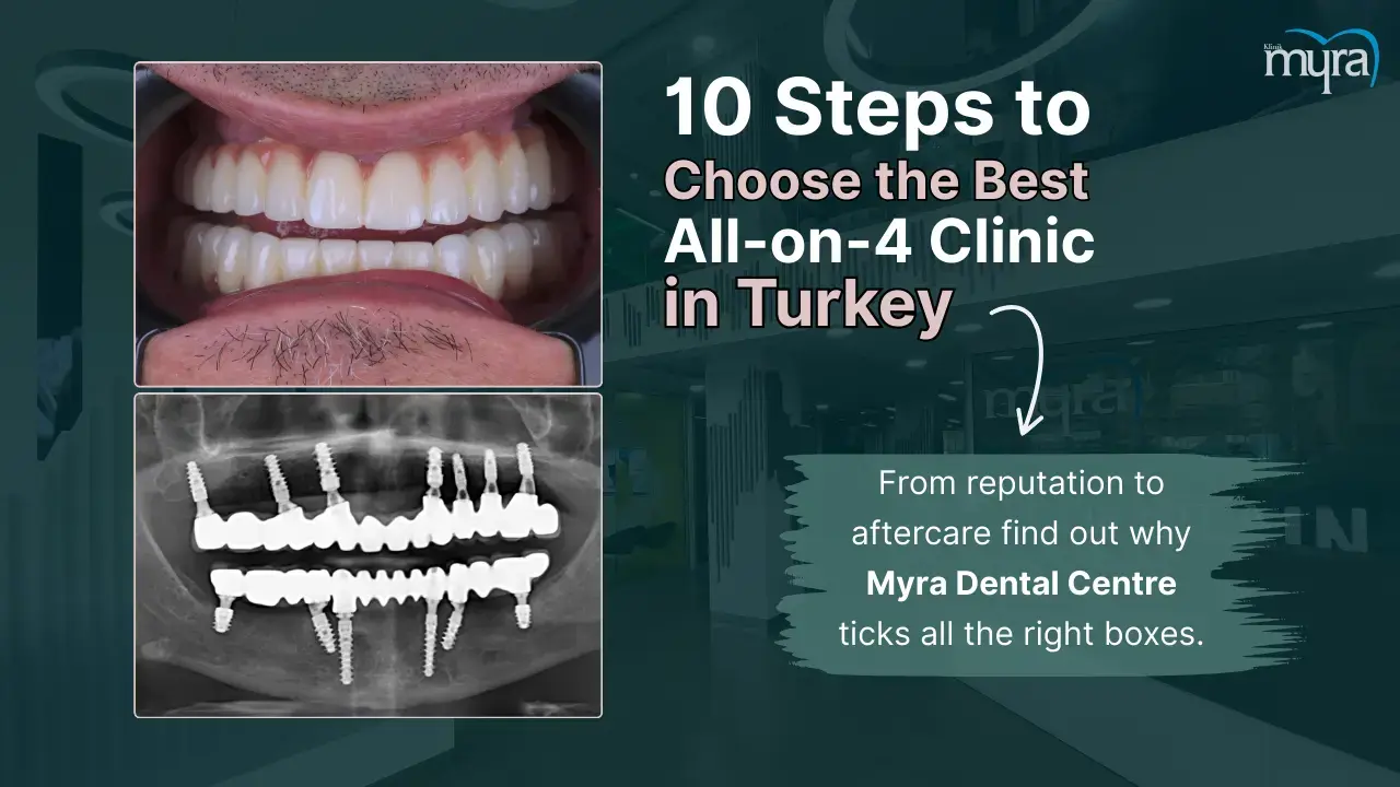how-to-choose-the-right-clinic-for-all-on-4-dental-implants-in-turkey