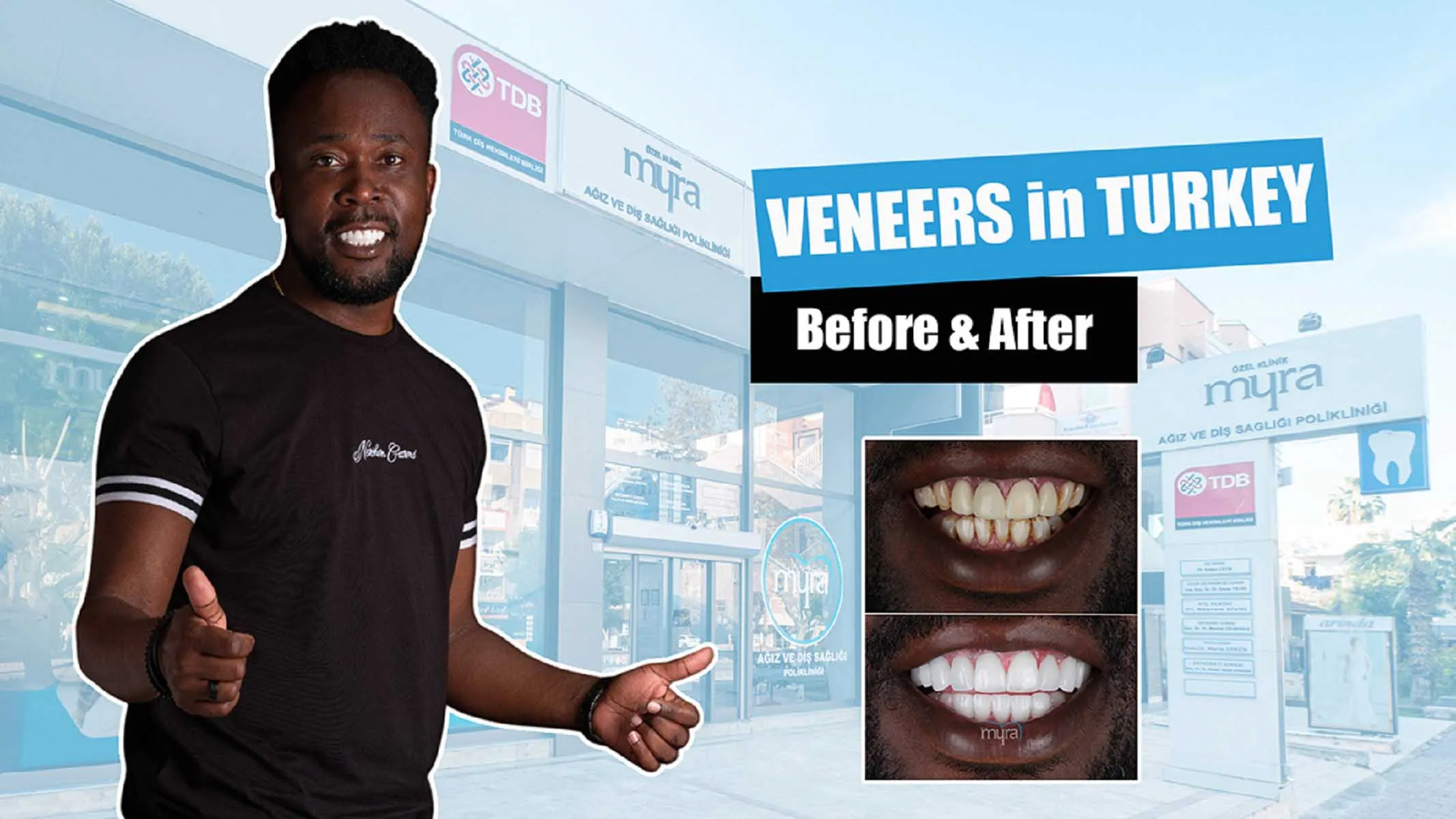 are-veneers-cheaper-in-turkey