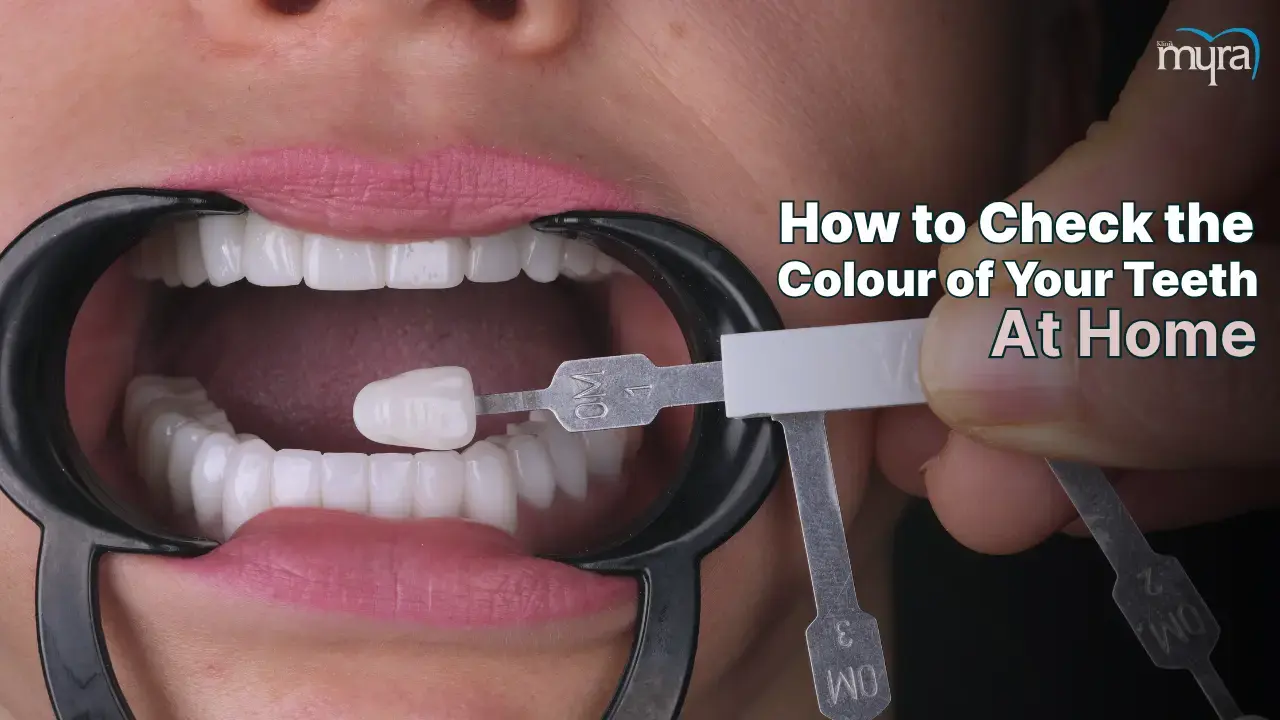 how-to-determine-the-colour-of-my-teeth