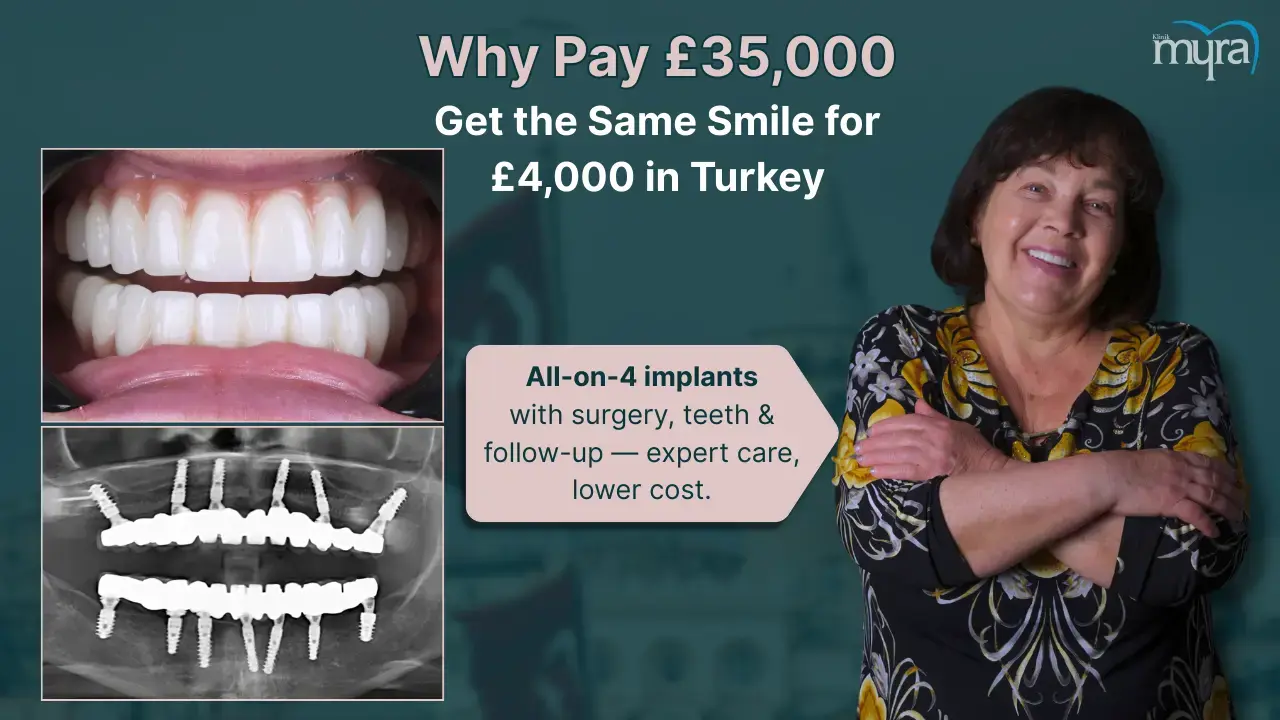 is-it-cheaper-to-get-all-on-4-dental-implants-in-turkey