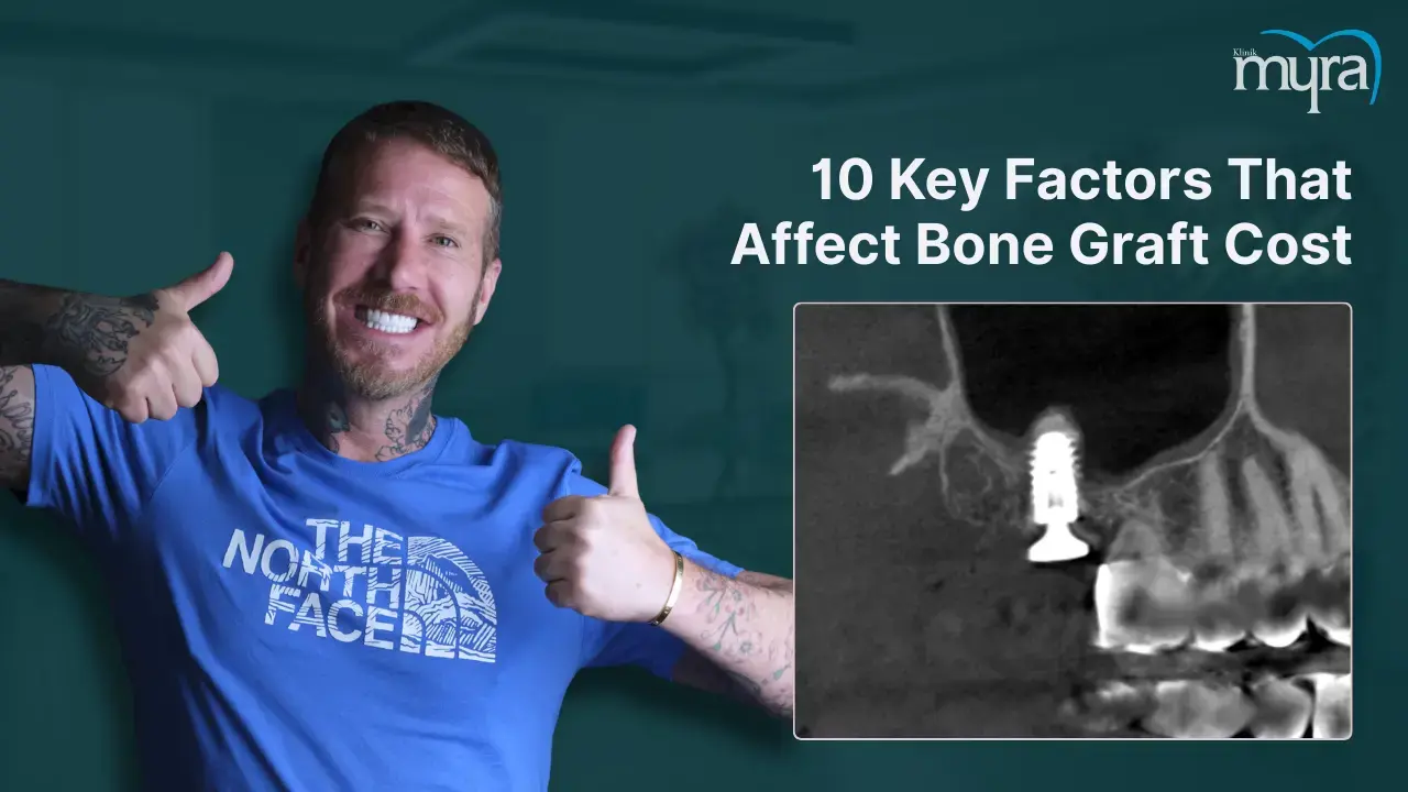 what-are-the-factors-affecting-the-cost-of-bone-grafting