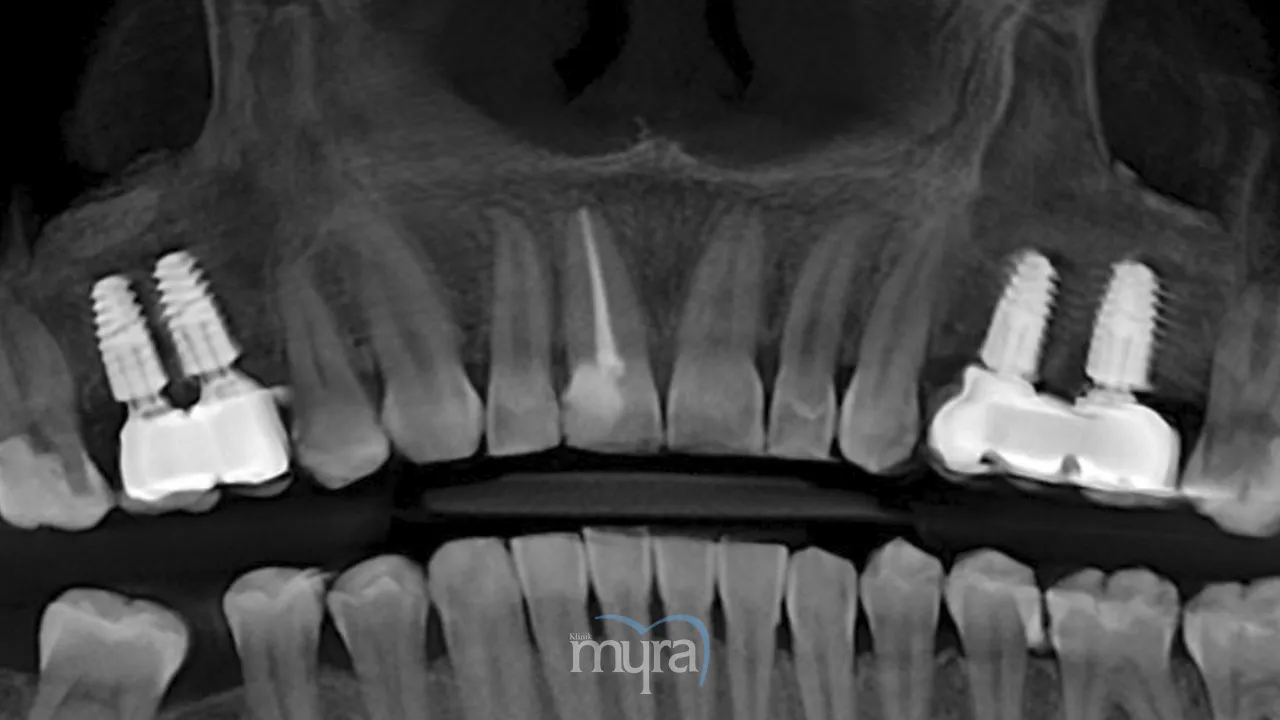 Comparative analysis of dental treatment between Costa Rica and Turkey 