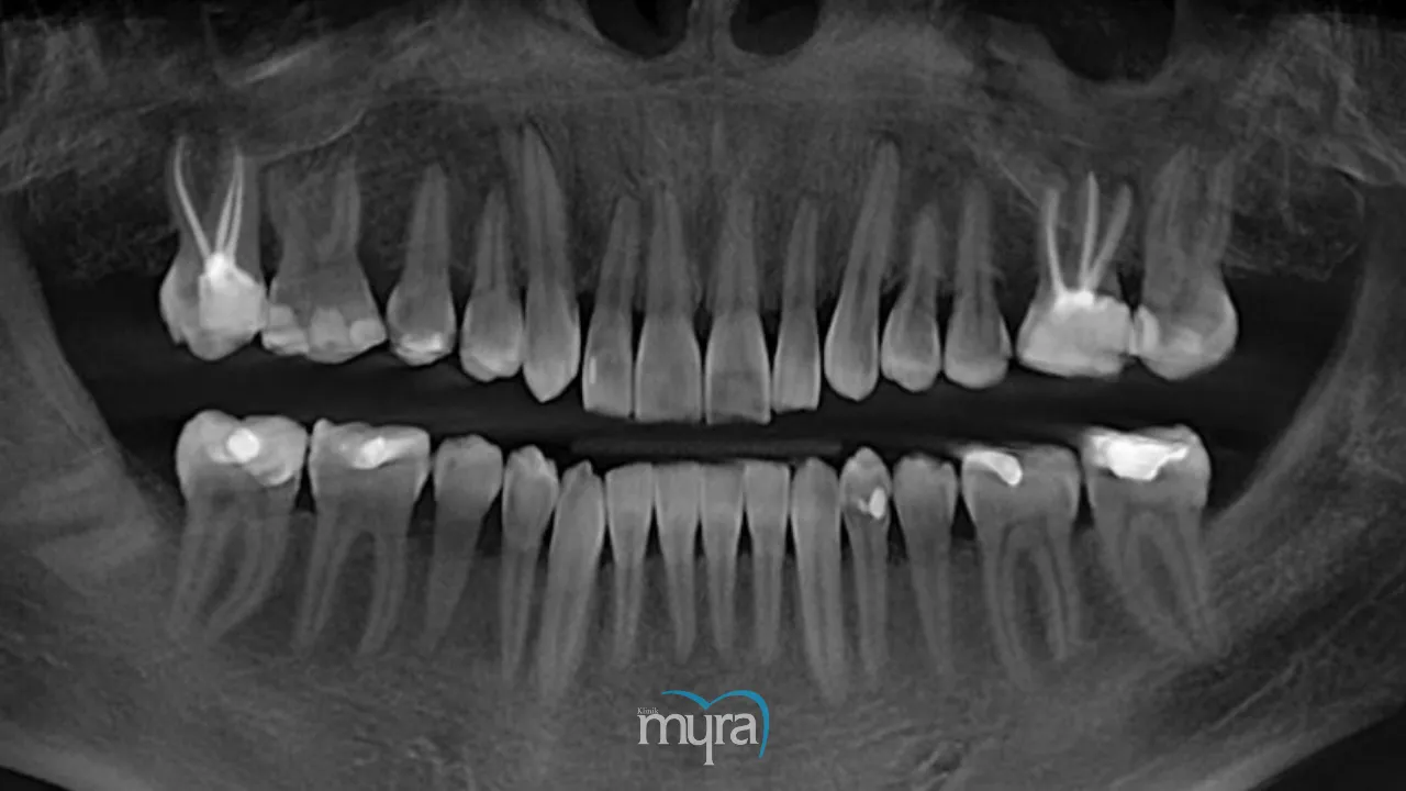 Comparative analysis of dental treatment between Costa Rica and Turkey 