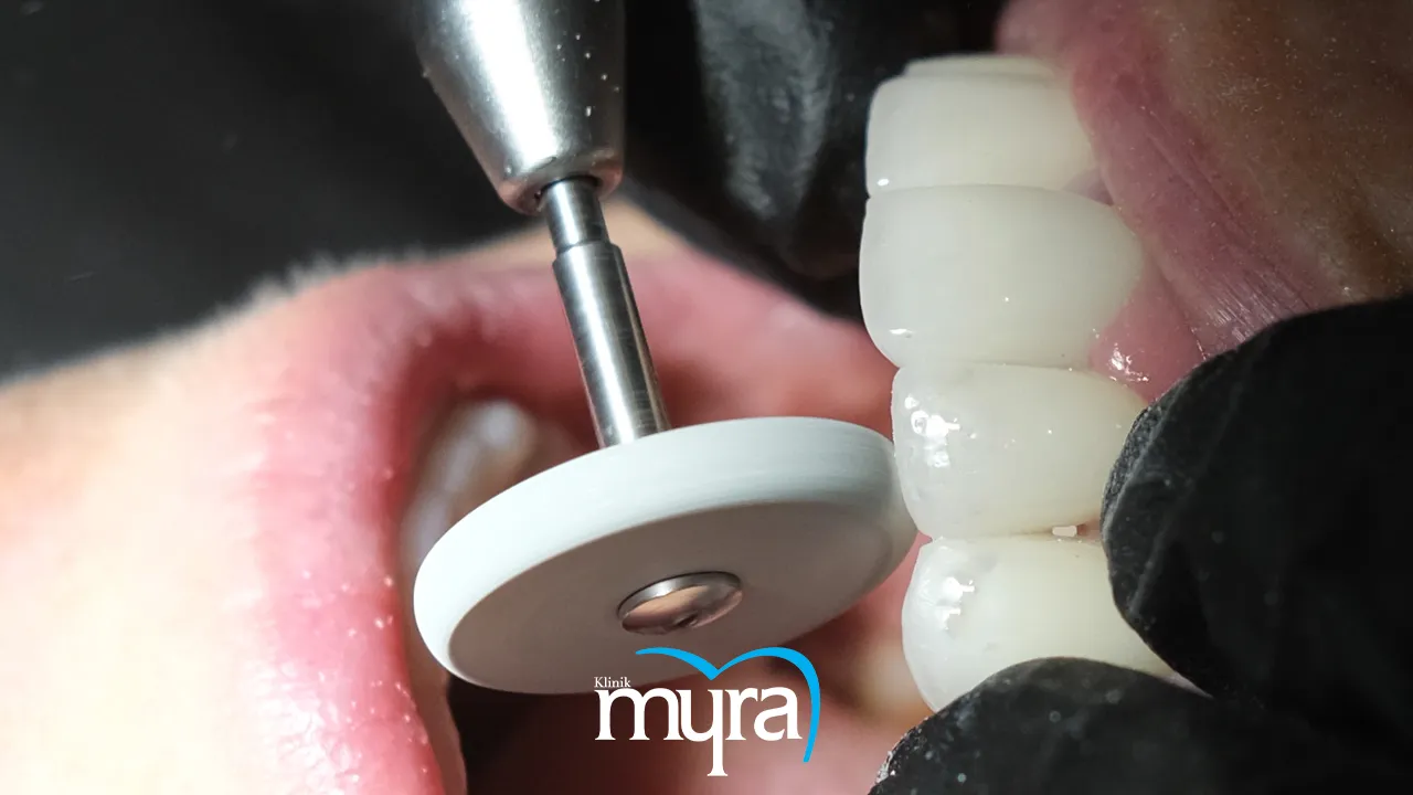 Myra Dental Centre - 7-types-of-dental-specialists