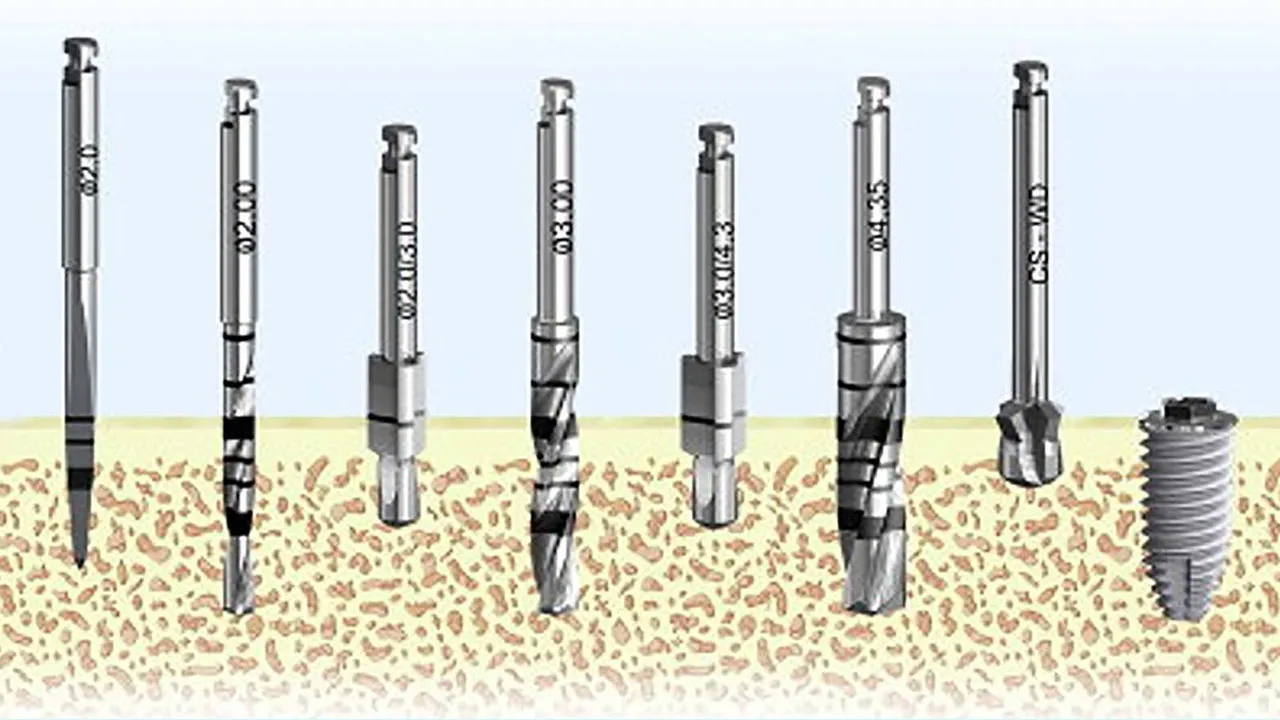 Types of Dental Implants