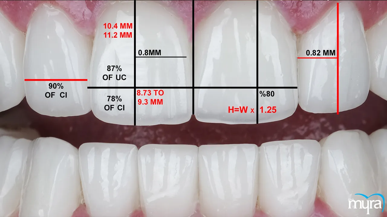 Principles of Smile Design