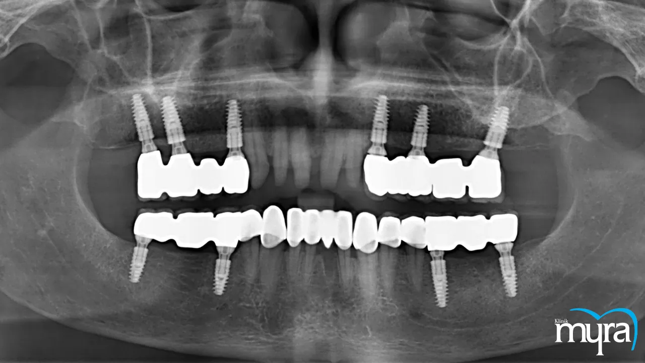 Smile Design Definition