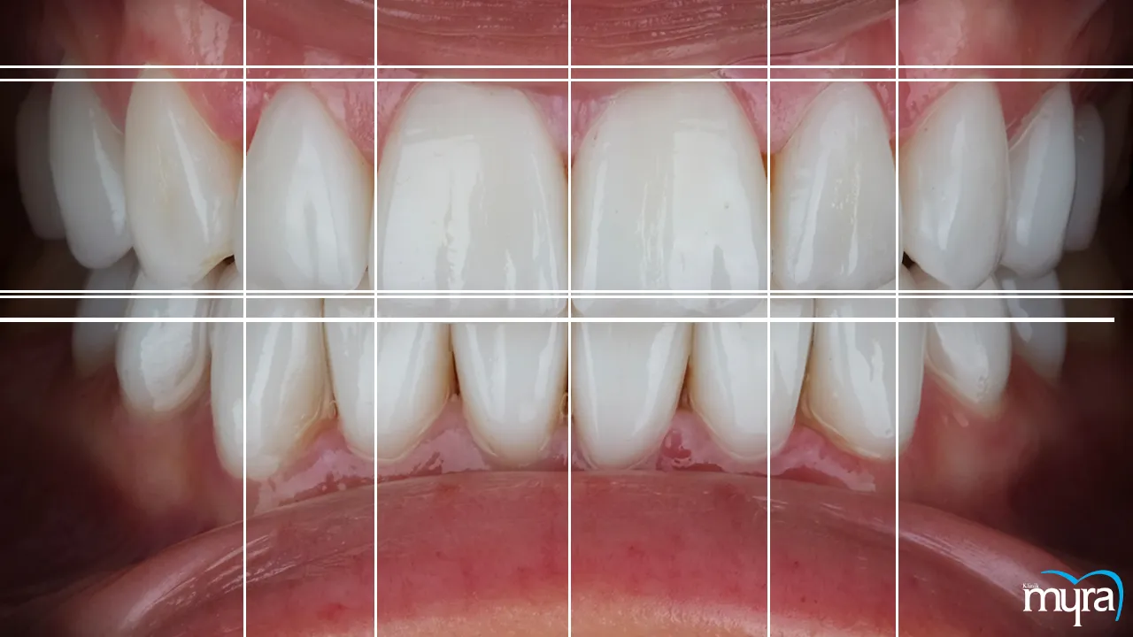 Digital Smile Design