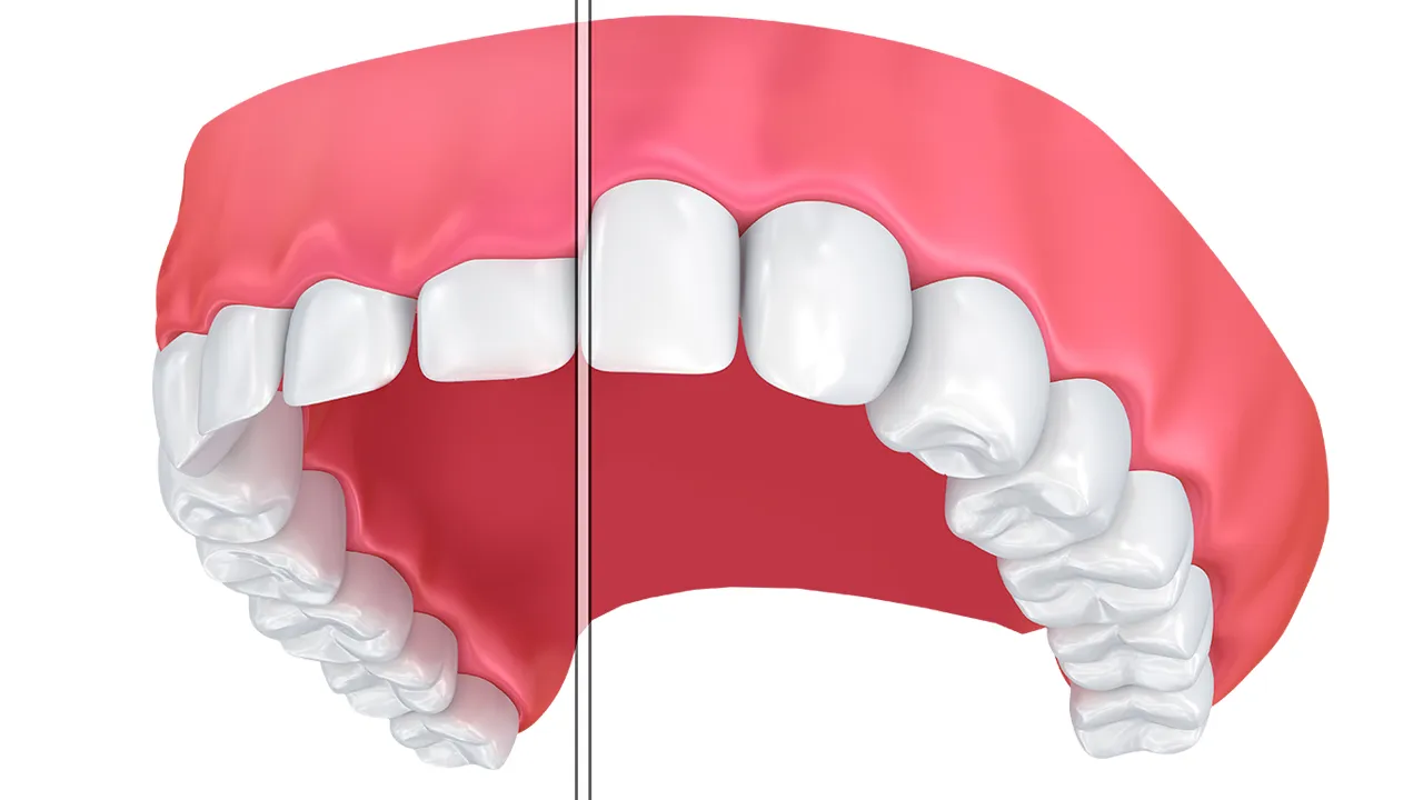 Smile Design Definition