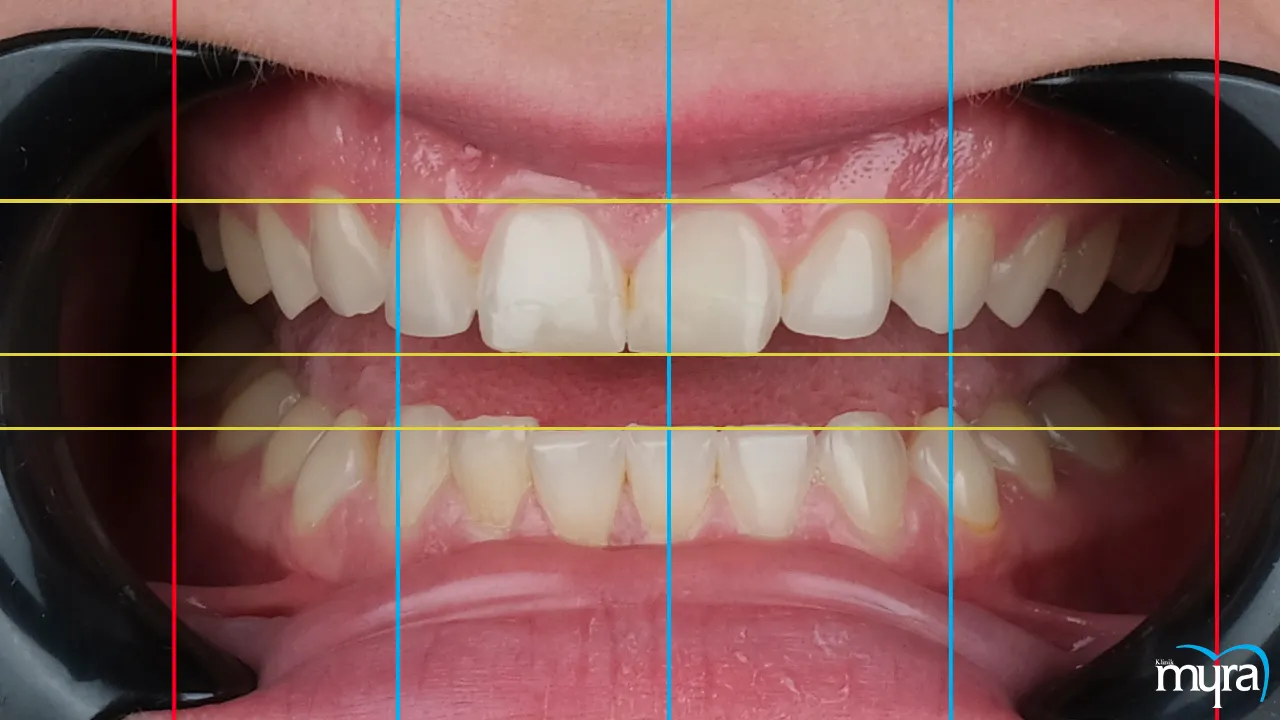 Digital Smile Design