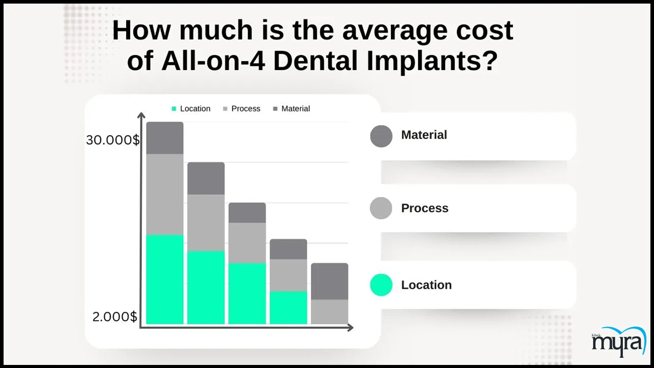 A Complete Understanding Of All-on-4 Dental Implant- Myra-Dental-Centre-Turkey