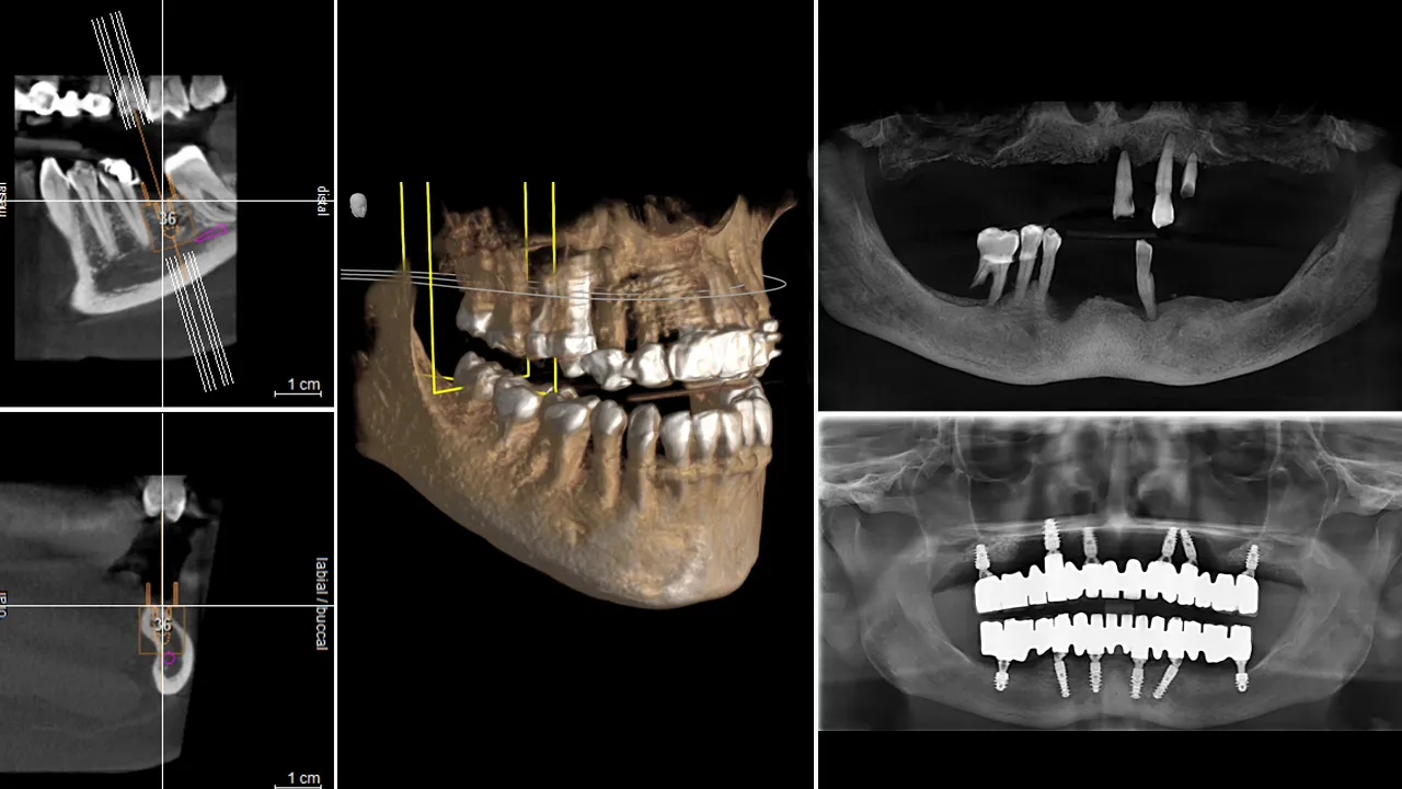 12 Essential Tips for Choosing a Turkish Dentist and Performing Dental Work in Turkey