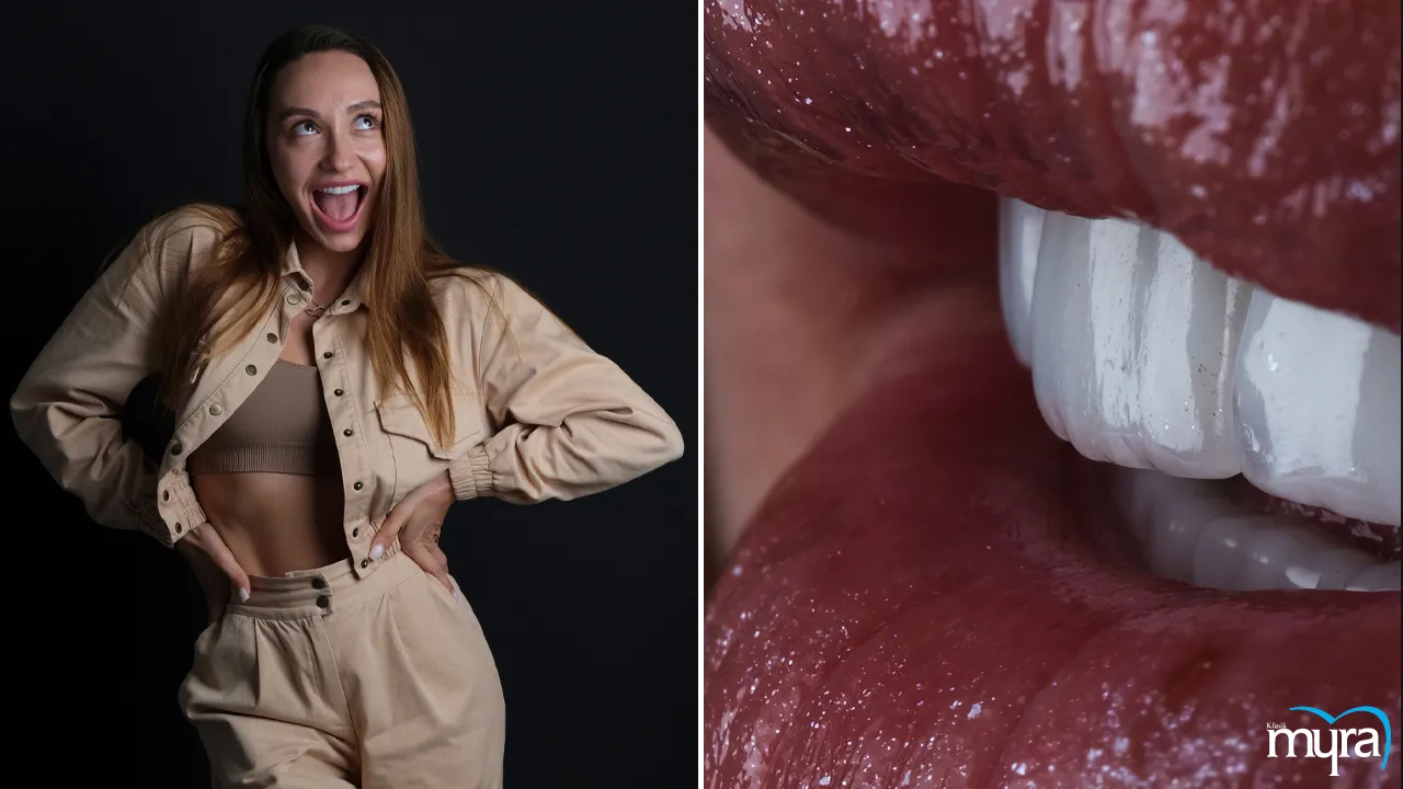 Myra Dental Centre Turkey - Benefits of obtaining a full set of veneers in Turkey