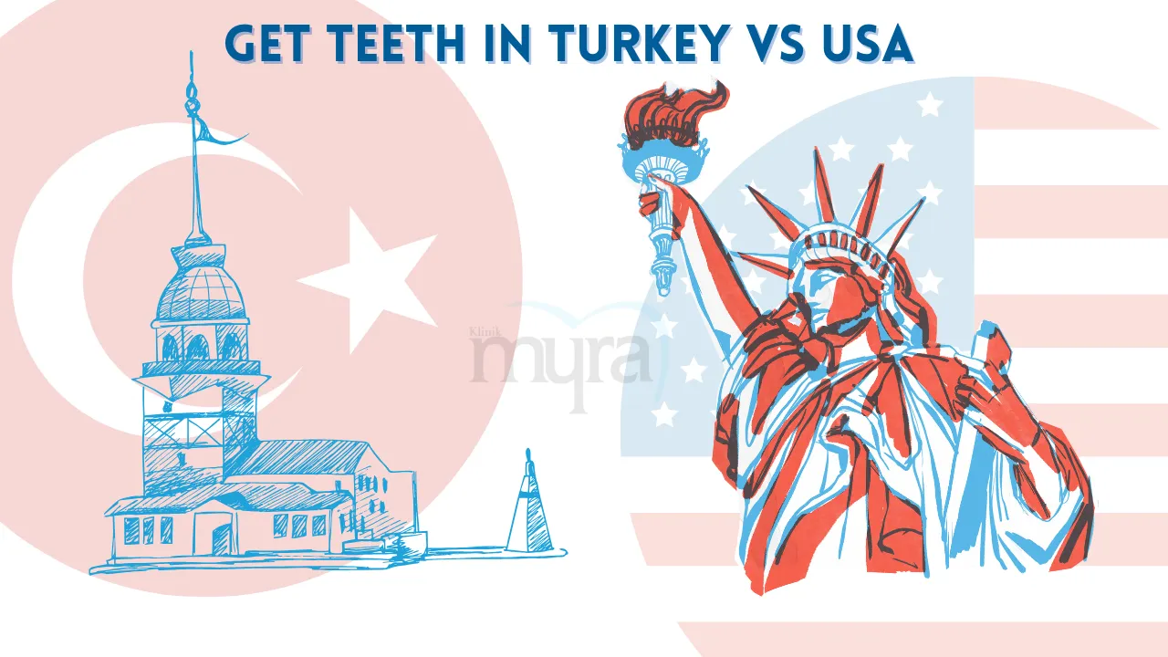 Comparison of veneer prices, benefits, and drawbacks between the USA and Turkey