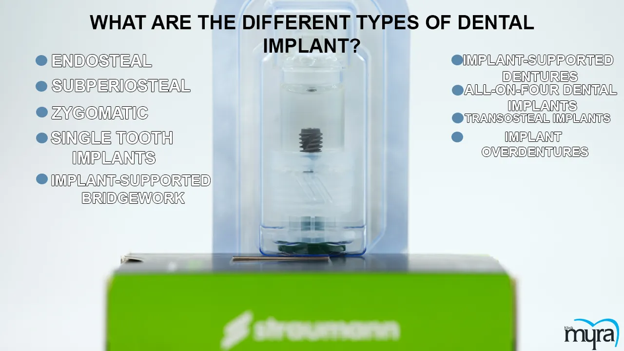 Dental implants