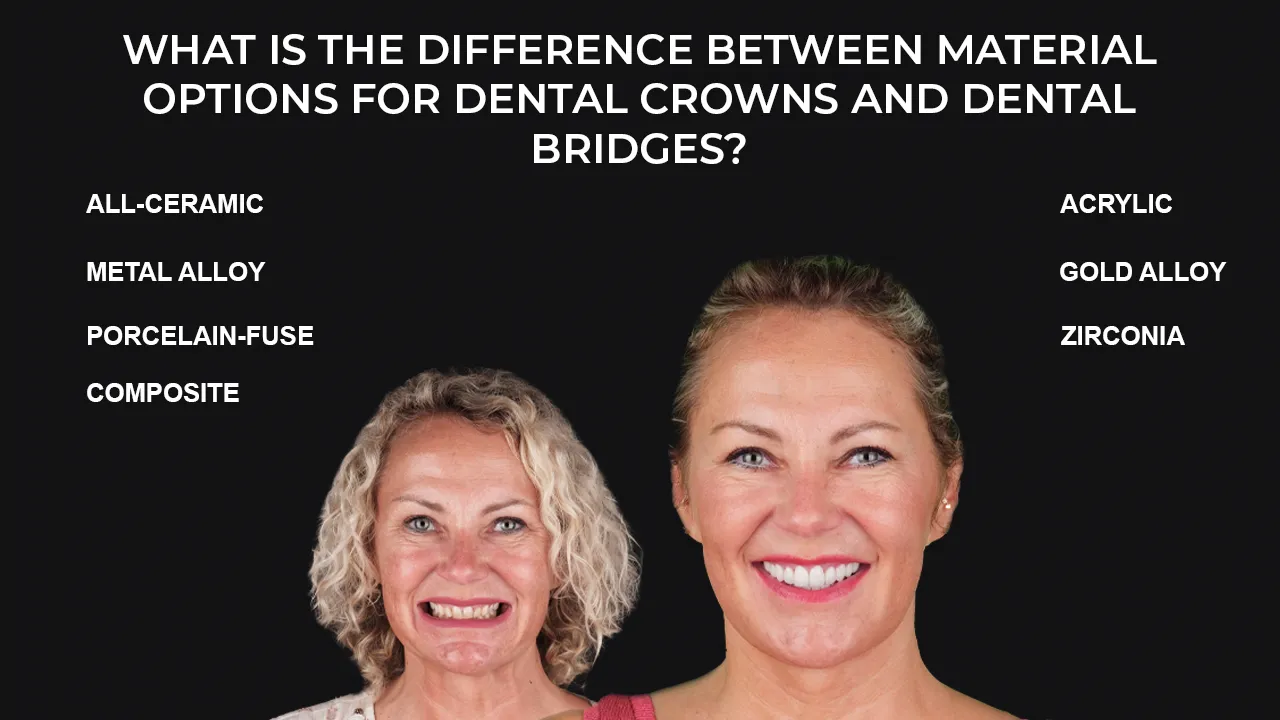 Crowns vs Bridges: Difference Between Dental Crowns and Dental Bridges