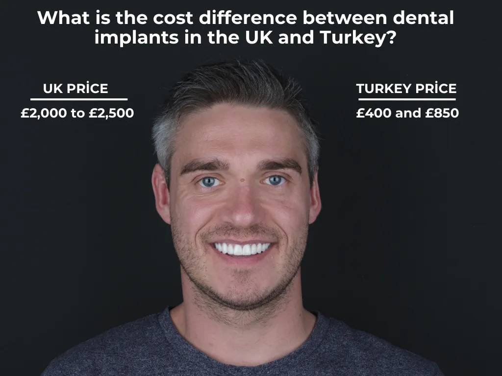 How do Dental Implant Clinics, Prices, Pros, and Cons in the UK Compare to Those in Turkey?