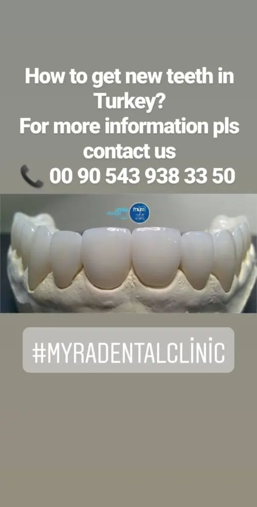 Myra Dental Centre Turkey - are-veneers-painful