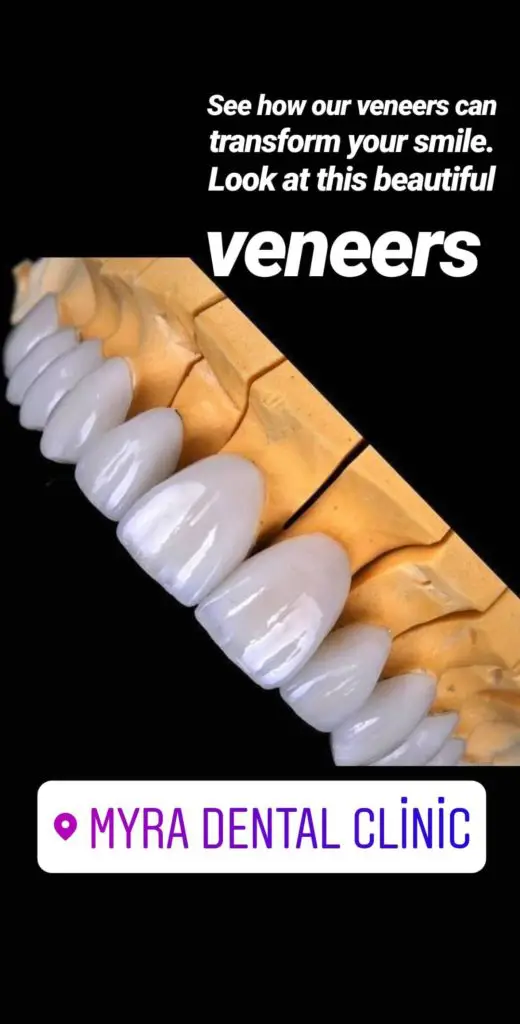 Myra Dental Centre Turkey - are-veneers-painful