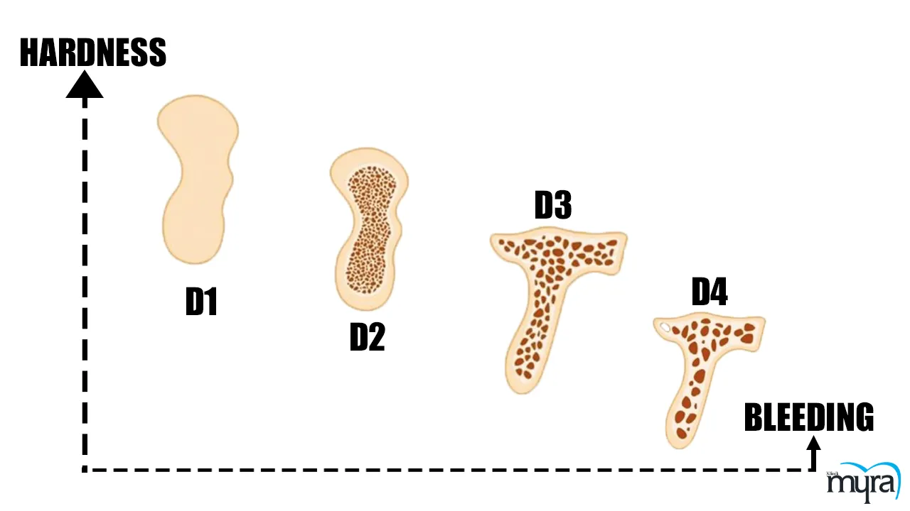 Dental Implant Techniques