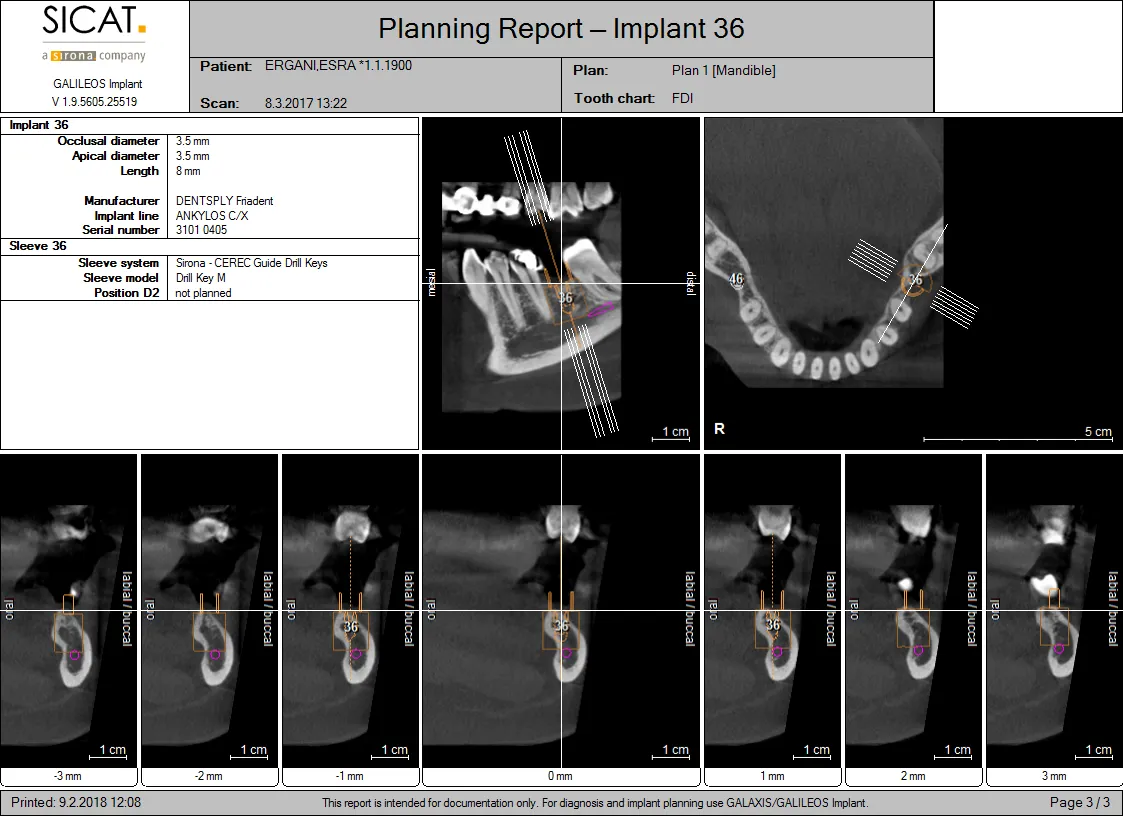 Myra Dental Centre Turkey - needs-to-know-about-dental-implants-in-turkey