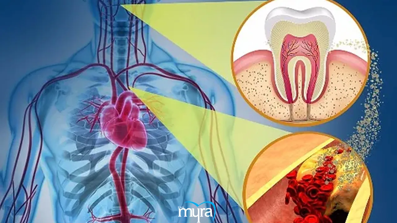 Myra Dental Centre Turkey - 7-factors-that-affect-success-of-dental-implant 