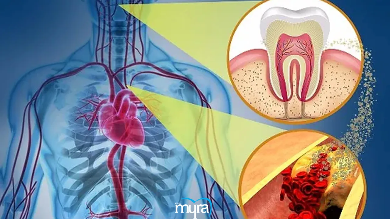 Factors that Affect Success Of Dental Implant