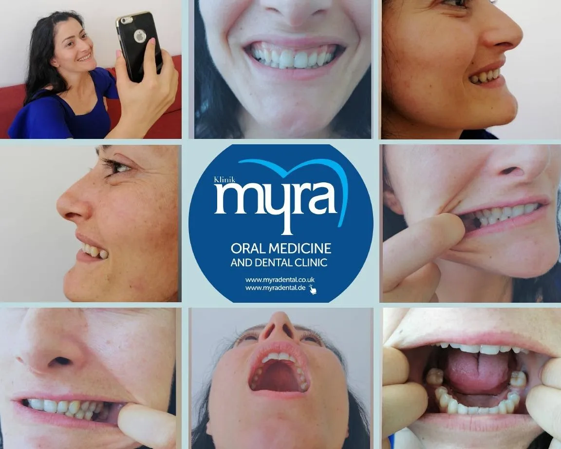 Myra Dental Centre Turkey - tips-you-need-to-know-about-turkish-dentists-and-dental-works-in-turkey