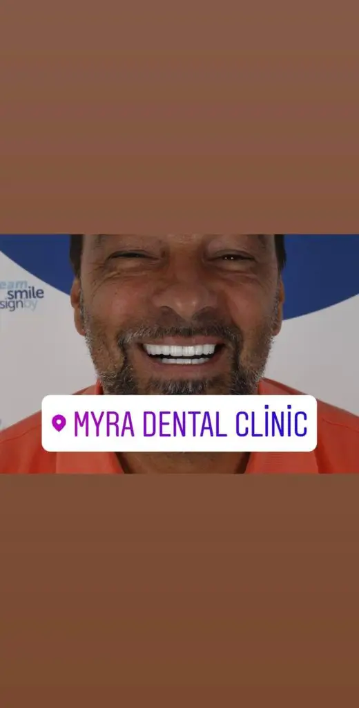Myra Dental Centre Turkey - veneers-in-mexico-vs-turkey-prices-pros-and-cons1