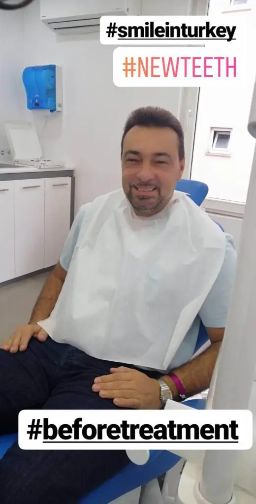 Myra Dental Centre Turkey - veneers-in-uk-vs-turkey-prices-pros-and-cons