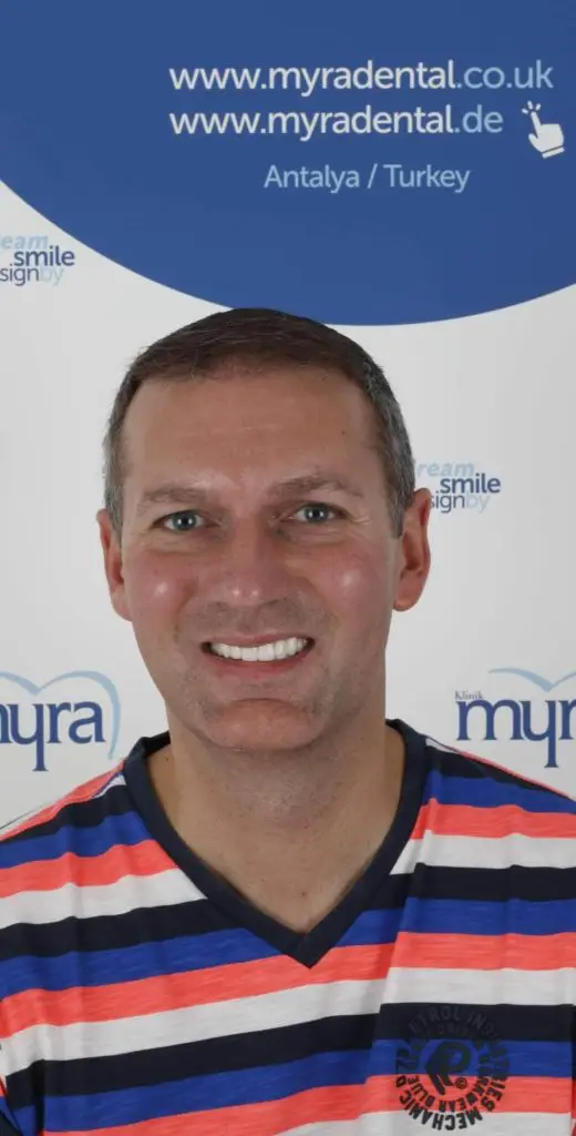Myra Dental Centre Turkey - veneers-in-usa-vs-turkey-prices-pros-and-cons