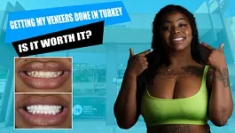 Getting-teeth-done-in-Turkey