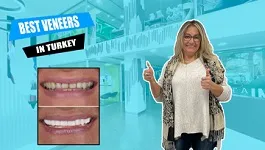 New-teeth-in-Turkey